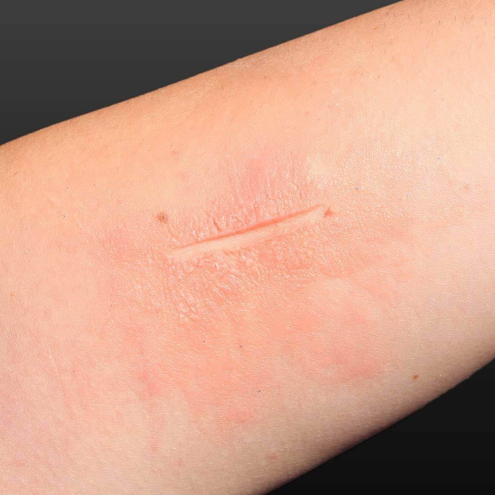 Cire pour fausse cicatrice - Spécial FX - effet sur la peau